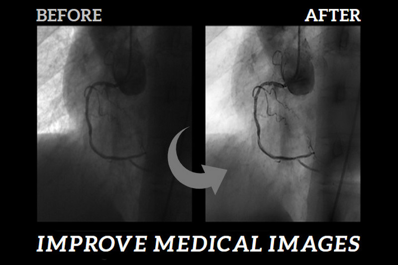 improve medical images